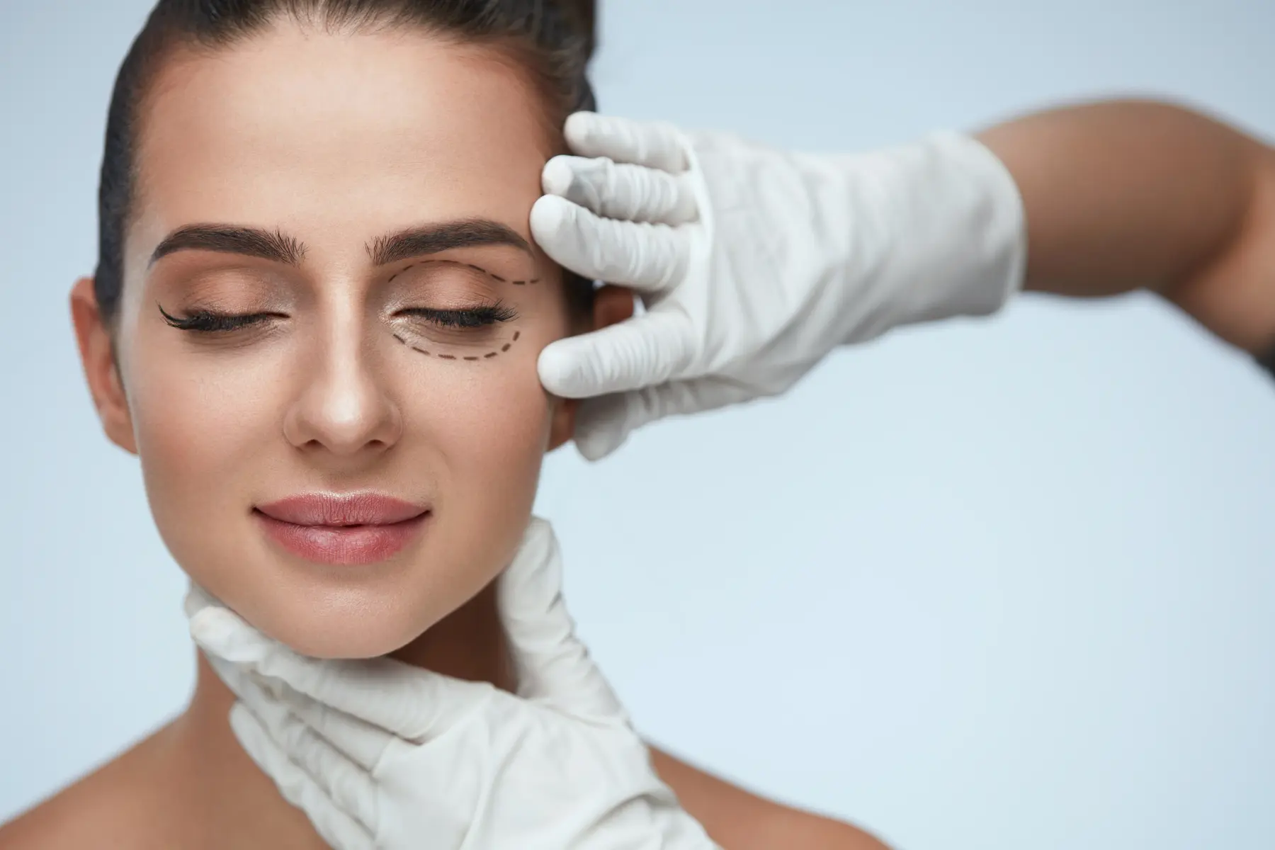 Plastic surgeon assessing woman's eye area with dotted lines and gloved hands.