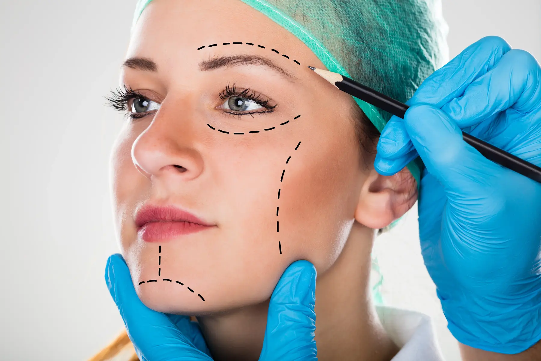 Surgeon marking woman's face for plastic surgery procedure.
